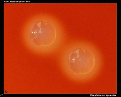 beta hemolysis